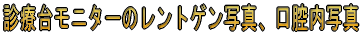 �f�Ñ䃂�j�^�[�̃����g�Q���ʐ^�A���o���ʐ^